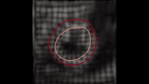 心脏病预警智能设备,人工智能预测心脏病死亡