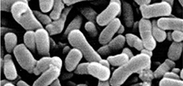 酸奶酵母菌的做法,制作酸奶要真菌还是细菌