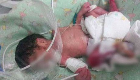 怀孕7个月的宝妈早产,早产7个月和早产8个月