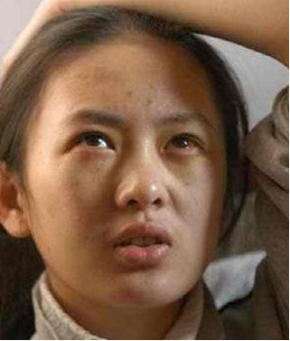 童瑶被张默打的图片,童瑶被张默打怎么处理的