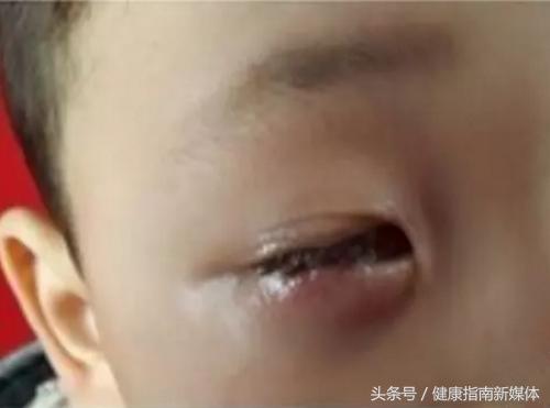 孩子误吞干燥剂,别慌,要先确定是哪一种!(干货收藏版)