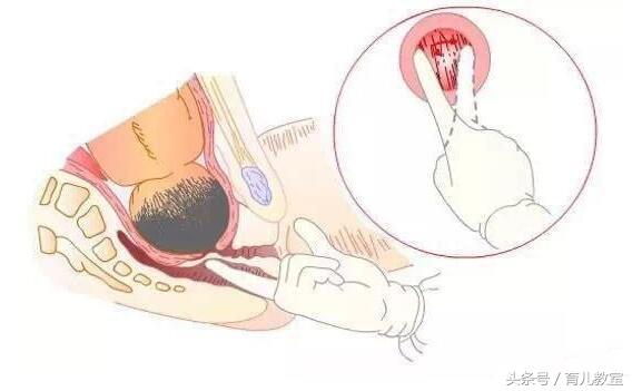 自然分娩的三个产程，打算顺产的准妈妈千万要记得