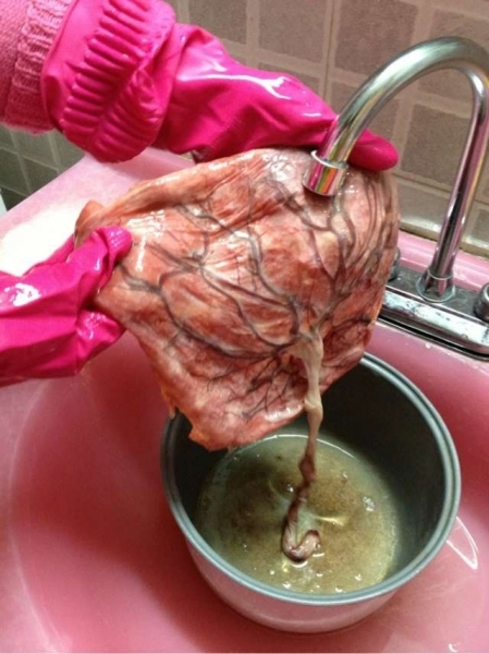 生完孩子胎盘怎么处理好,大家生完宝宝胎盘都怎么处理了