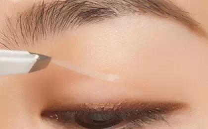 怎么把单双眼皮变成双眼皮,单眼皮怎么变双眼皮不用手术