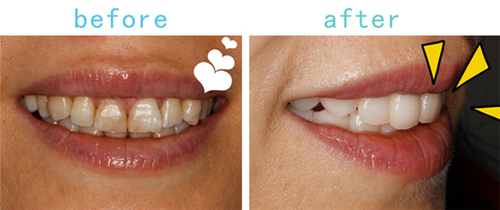 经常涂口红嘴唇会怎么样,经常涂口红20年后会发生什么