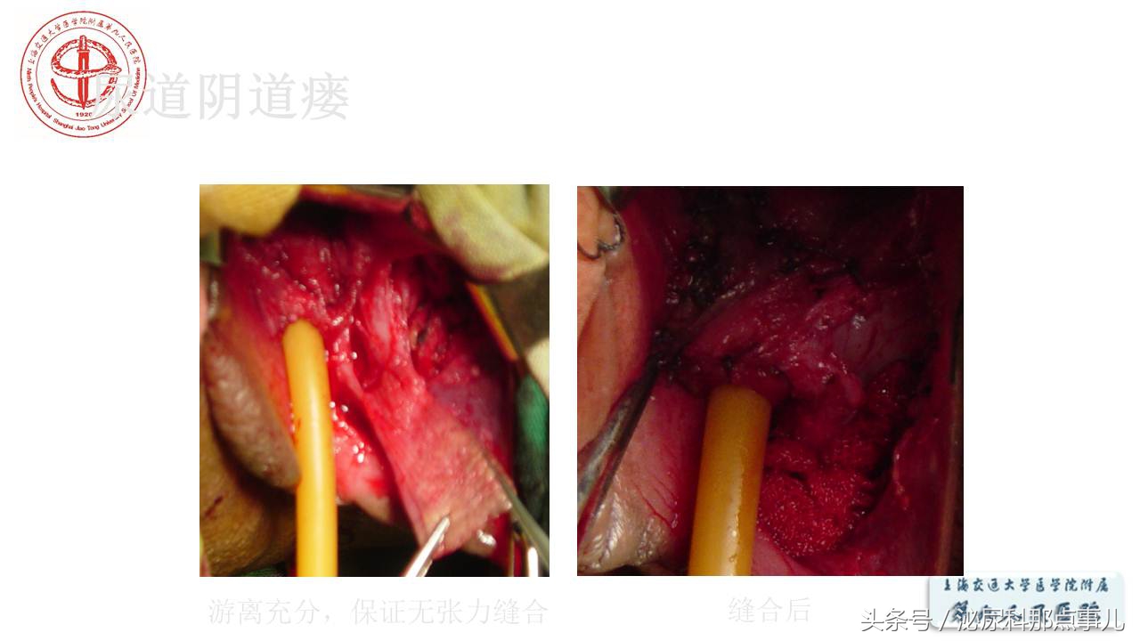 泌尿男科王忠教授,泌尿外科专家王忠教授