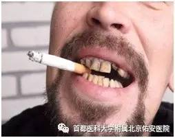 佑安医院治什么病最好,佑安口腔专科