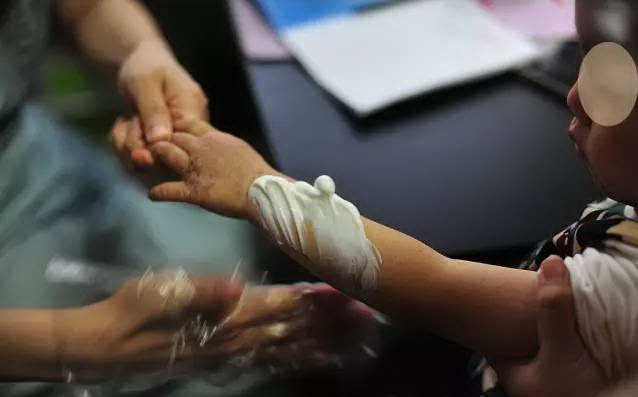 肤乐霜最新消息,肤乐霜不用代购了但值得买吗