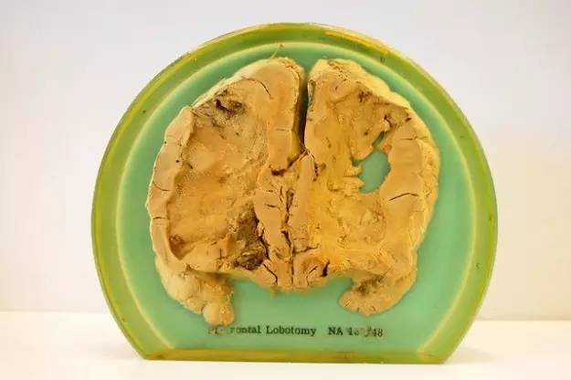 世界十大奇葩疗法,世界上最奇葩的传统疗法