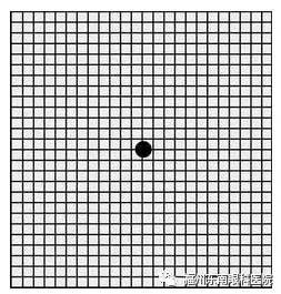 看东西变形视力下降,看东西变形眼底没问题