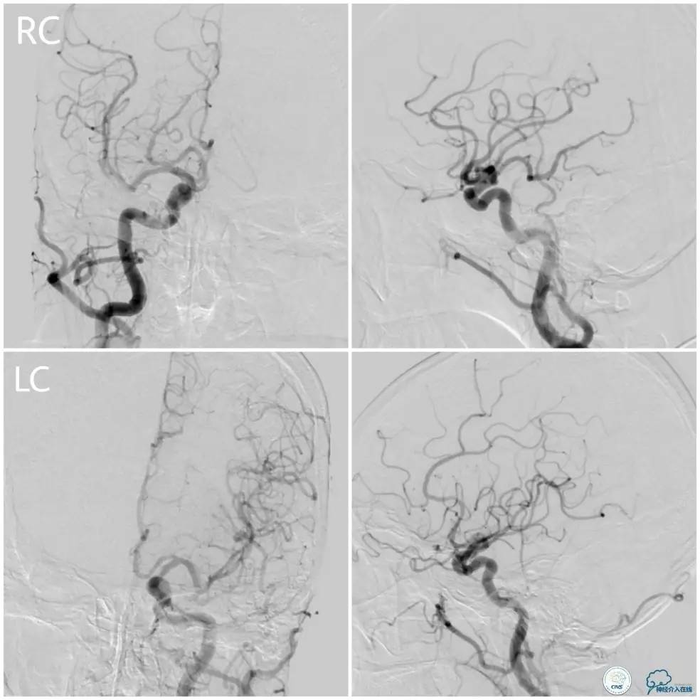 天坛椎动脉狭窄,天坛周记