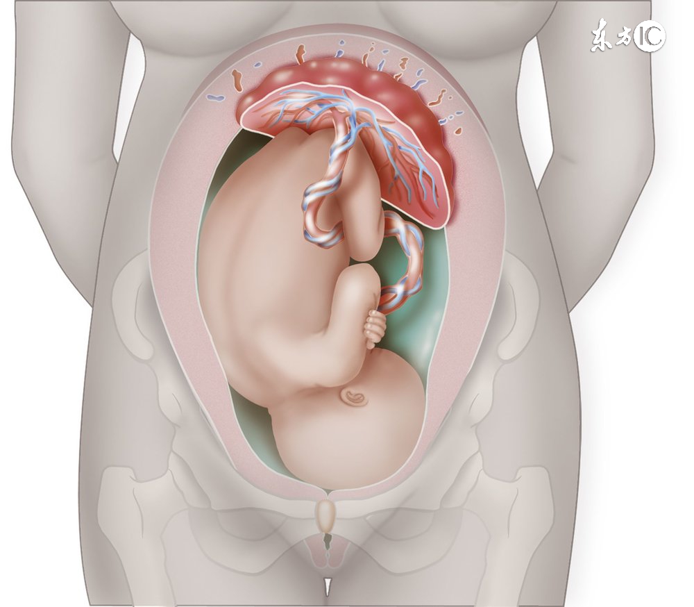 宝宝脐带绕颈孕妈怎么做才好,胎儿绕颈一周妈妈该怎么做
