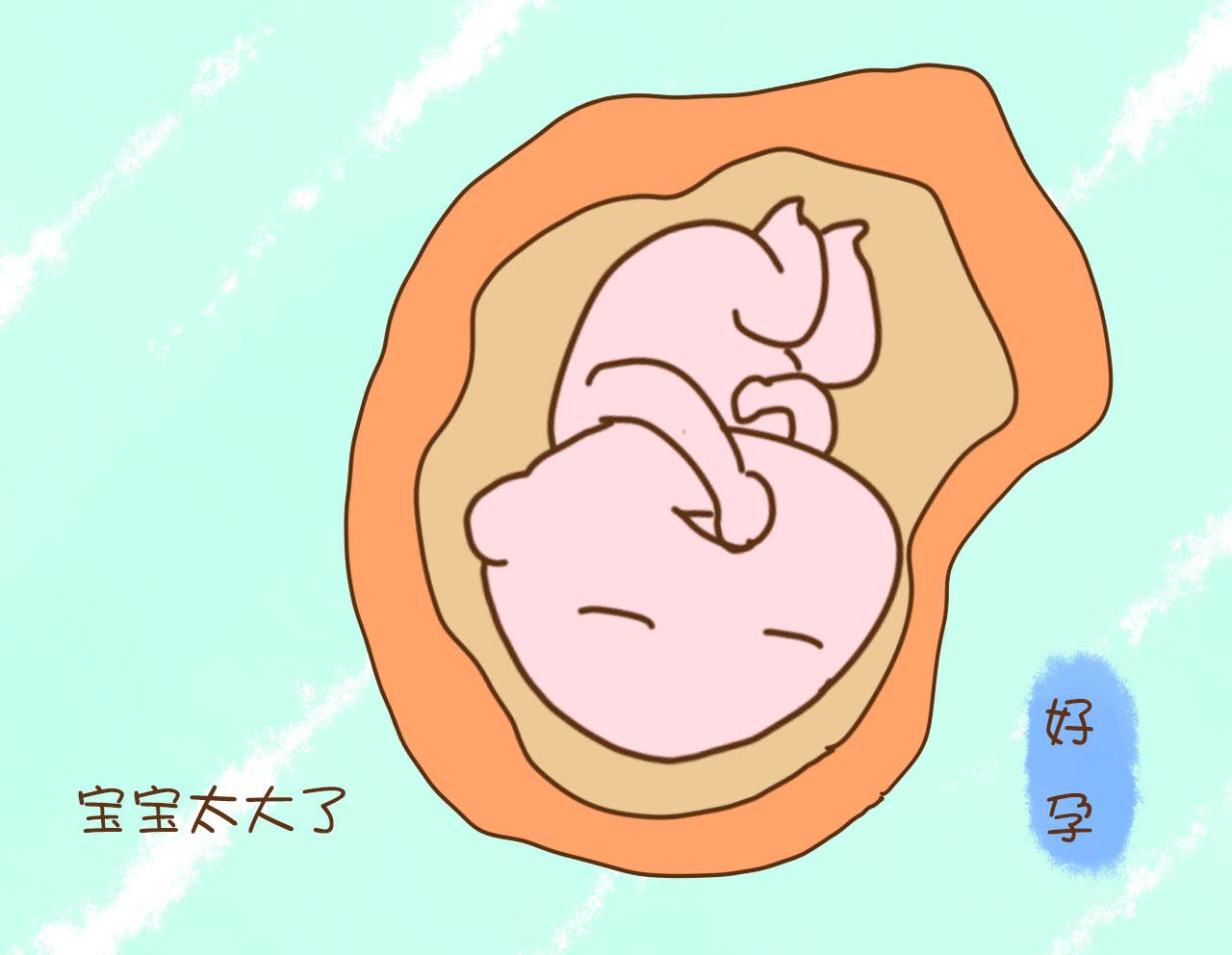 我国顺产率是多少,我国顺产剖腹产的比例