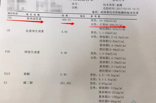 泌乳素垂体瘤中医怎么治疗,泌乳素型垂体瘤患者自述