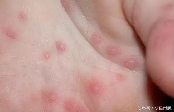 一招解决宝宝不爱喝奶,别再错怪孩子了