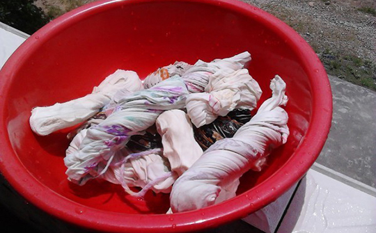 把屎把尿导致孩子脱肛是痔疮吗,婴幼儿脱肛跟把屎把尿有关系么