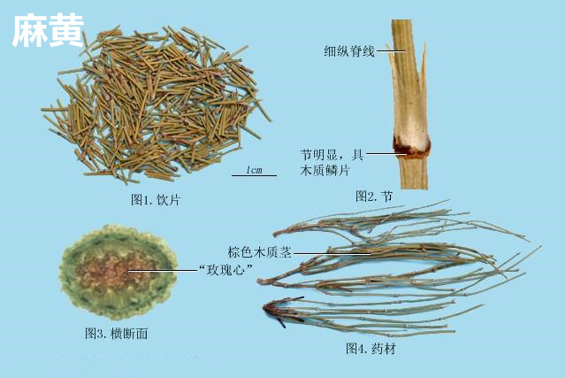 麻黄能够治疗脑中风吗？李可与胡希恕的世纪之争