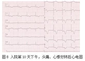 心前区疼痛、憋闷、咽部有紧缩感，伴出汗、呕吐可能是什么病？