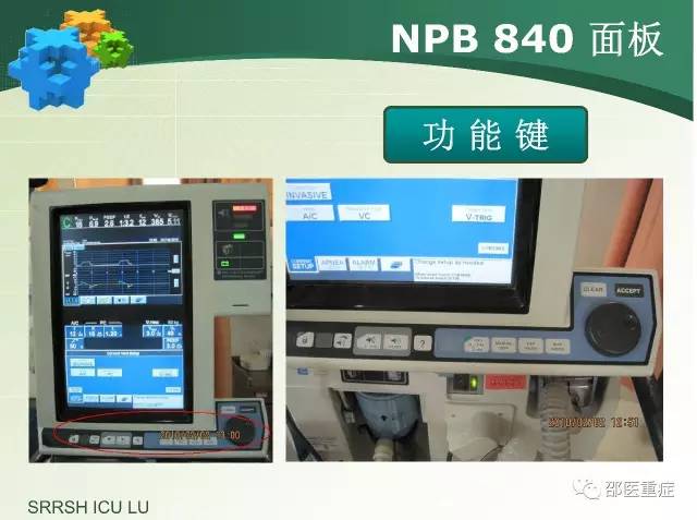 有创机械通气操作,机械通气英文缩写
