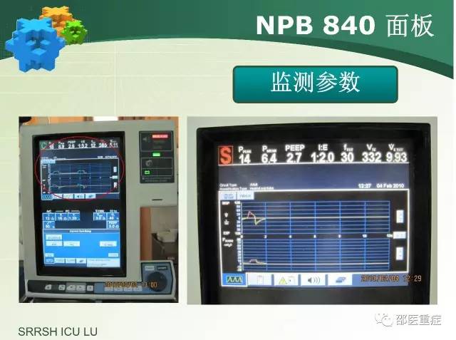 有创机械通气操作,机械通气英文缩写