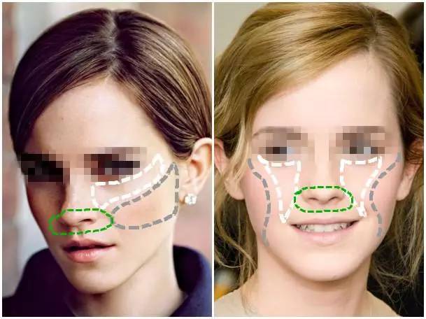 美女与野兽|天生法令纹只能靠整容吗?那是因为你没看这篇!