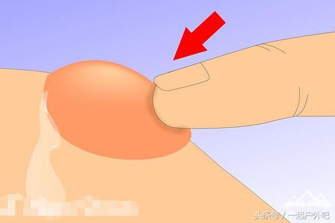 徒步如何避免起水泡,徒步怎么防止脚打泡