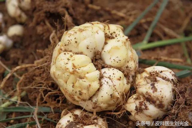 读故事，学中药——能治痨伤咳血的“大蒜头”——百合