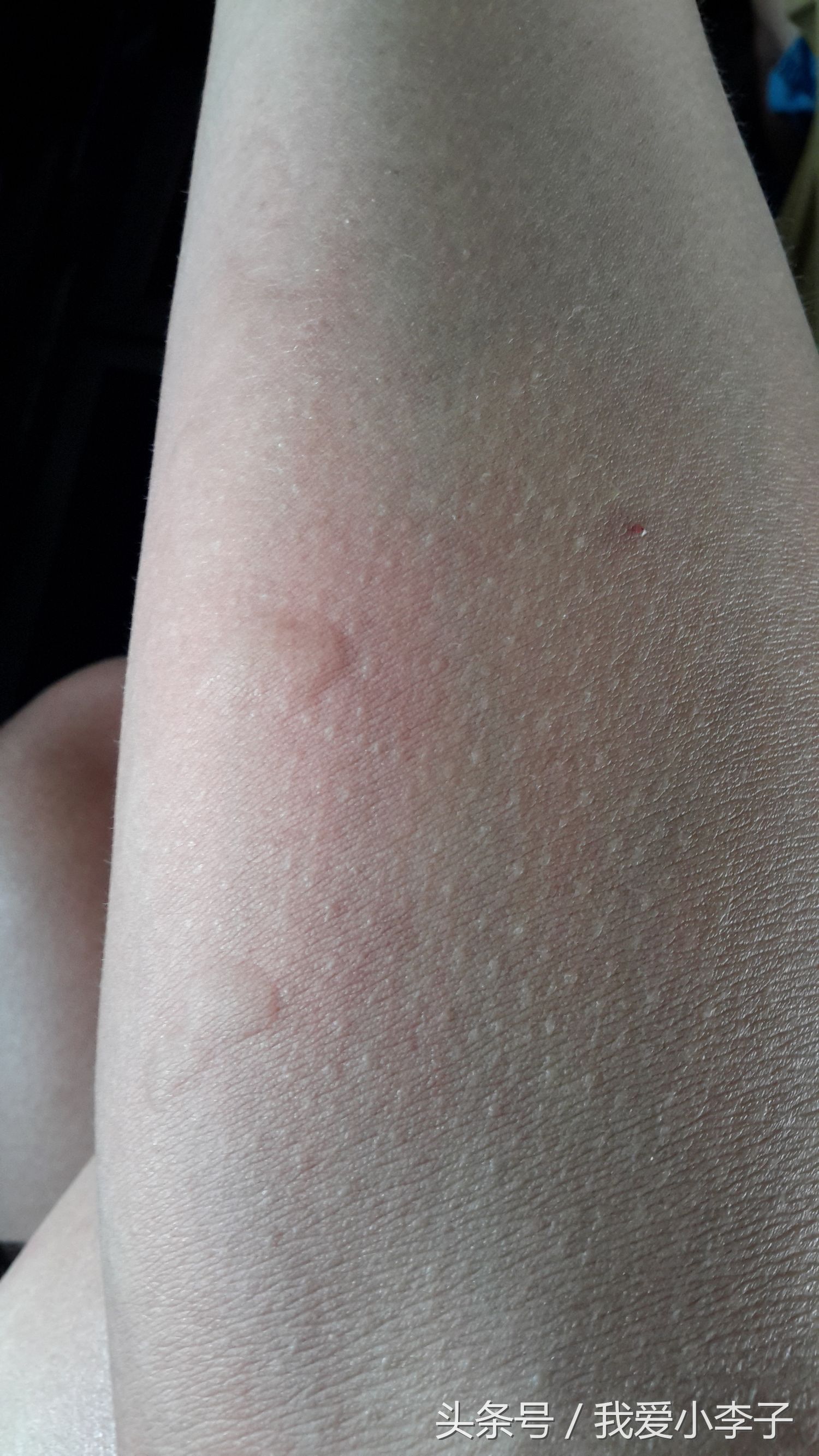 越南旅游住民宿和旅馆区别,越南旅游住公寓酒店怎么样