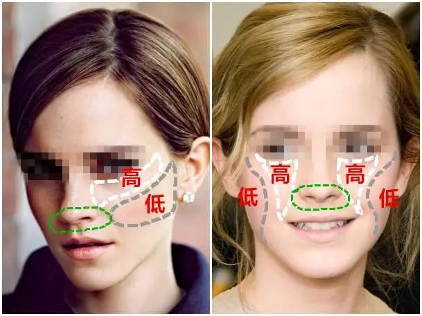 美女与野兽|天生法令纹只能靠整容吗?那是因为你没看这篇!