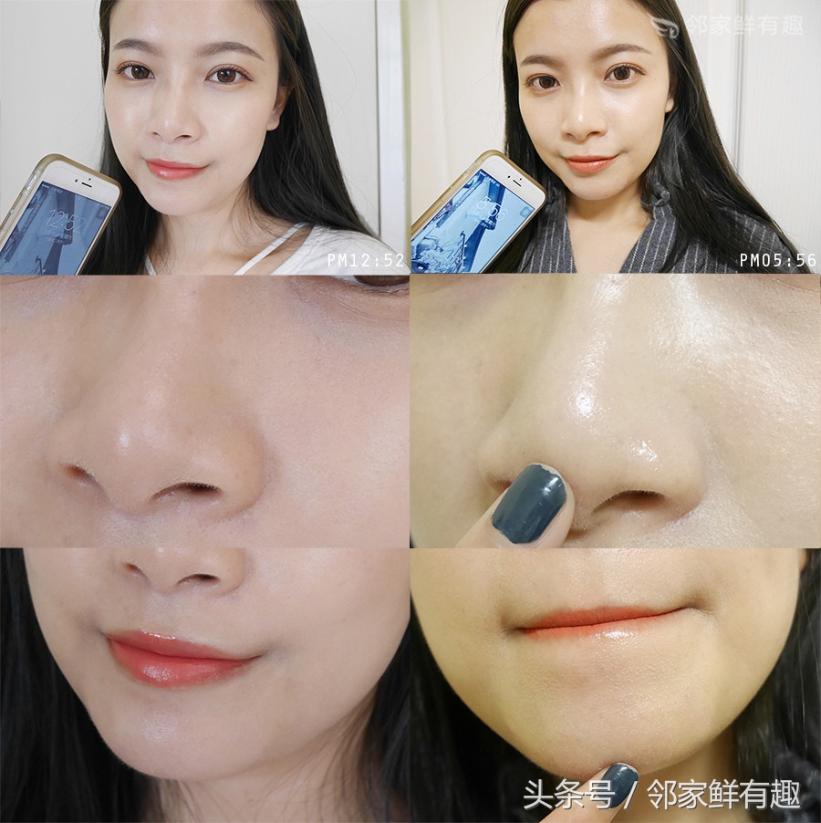 消除皮肤泛红,消除敏感肌角质层薄