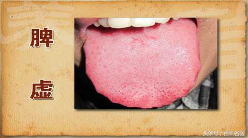 神疲乏力气短懒言怎么办,神疲乏力少气懒言吃什么