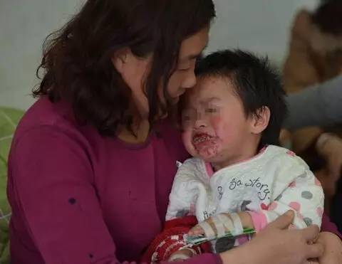 小伙因吃东西被噎死,小伙吃海鲜导致死亡