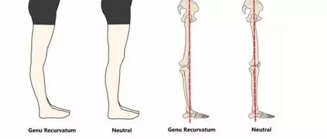 小腿结构图示图片,小腿骨骼构造示意图