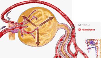 慢性肾衰竭尿素氮高了怎么办,肾衰尿素肌酐尿酸都高怎么办