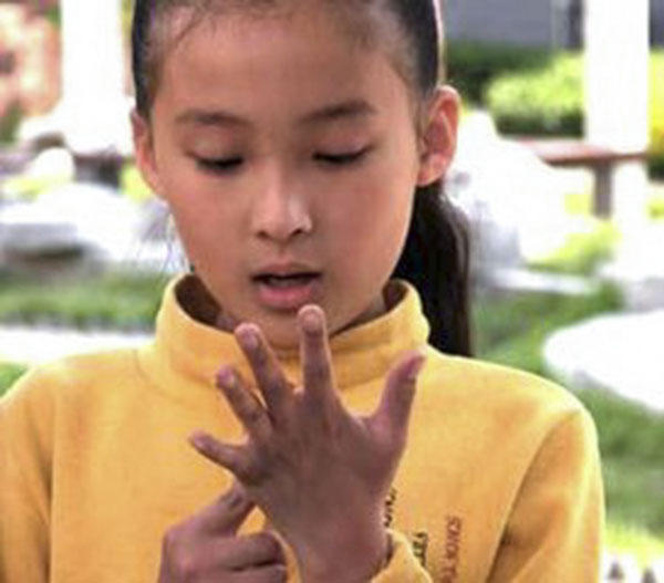 手掌脱皮中医,手掌脱皮中医怎么说