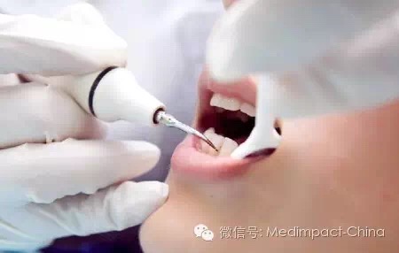 洗牙能得艾滋病吗,洗牙真的会感染艾滋乙肝吗