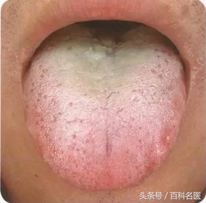 舌头舌诊,如何快速辨舌诊