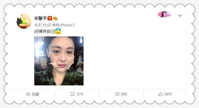 钟丽缇美白针,钟丽缇刮痧脸部