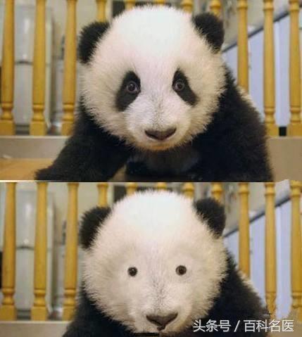 中医治疗青少年熊猫眼,消除熊猫眼的穴位