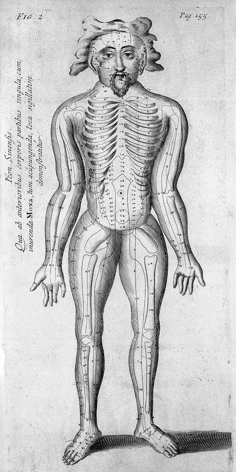 针刺治病法,为什么针灸可以治病