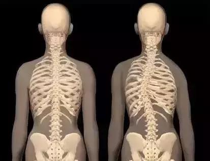 练胸肌一边胸大一边胸小怎么解决,为什么有的人胸肌面积小