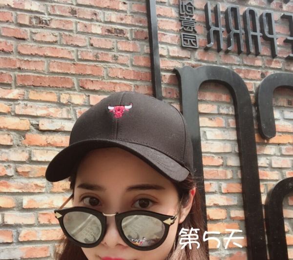 鼓起勇气做了个双眼皮,鼓起勇气做了医美