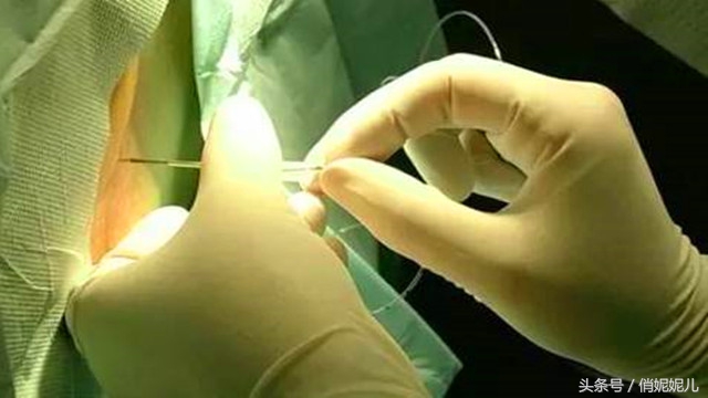 我的无痛顺产经历希望对即将“卸货”的你有一点帮助