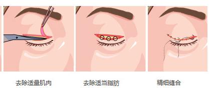 怎样让小眼睛变大眼睛,怎么将小眼睛变大p图