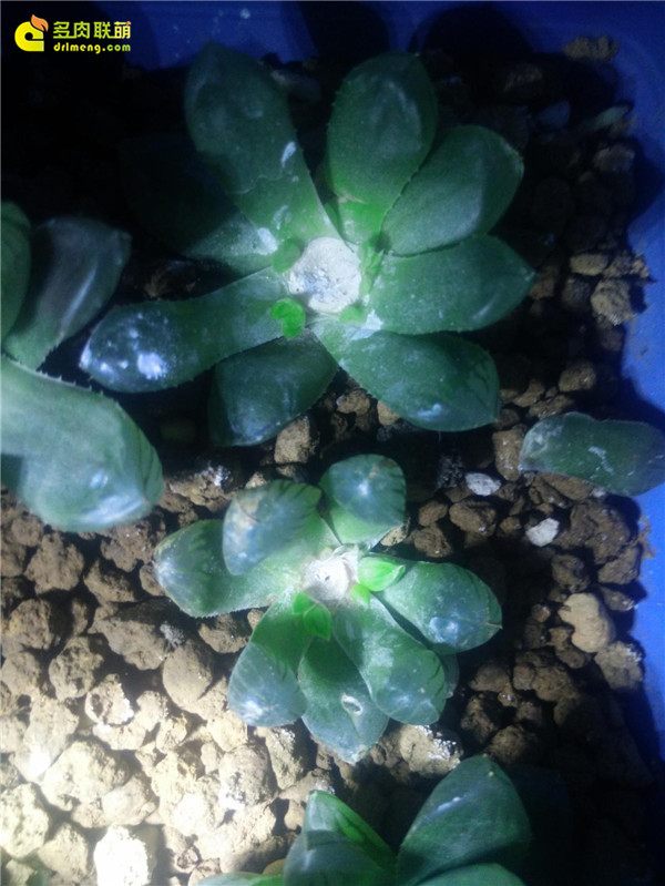 一个脚气患者的真实故事,关于癣有趣的故事