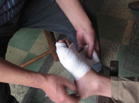 痛风引起的脚趾头疼怎么办,痛风脚趾头长期肿痛吃什么药消肿