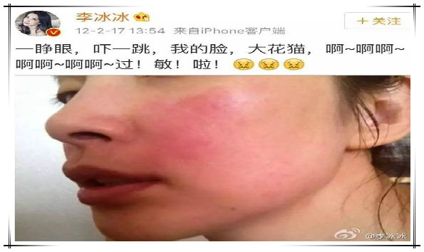 最有效抗过敏茶,可以舒缓皮肤过敏的茶