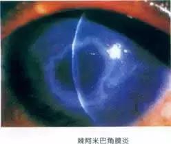 戴隐形眼镜洗手没有洗手液,隐形眼镜被水泡过不好戴了