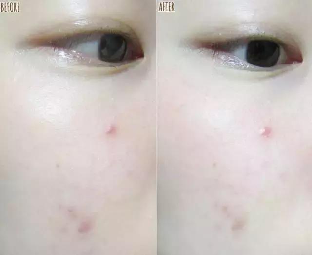 7合一清洁面膜,敏感皮肤清洁面膜去黑头