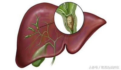 胆囊息肉应该怎么办？面瘫用什么办法比较好？